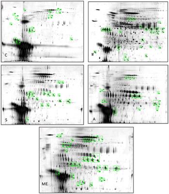 Analysis of Urine Composition in Type II Diabetic Mice after Intervention Therapy Using Holothurian Polypeptides